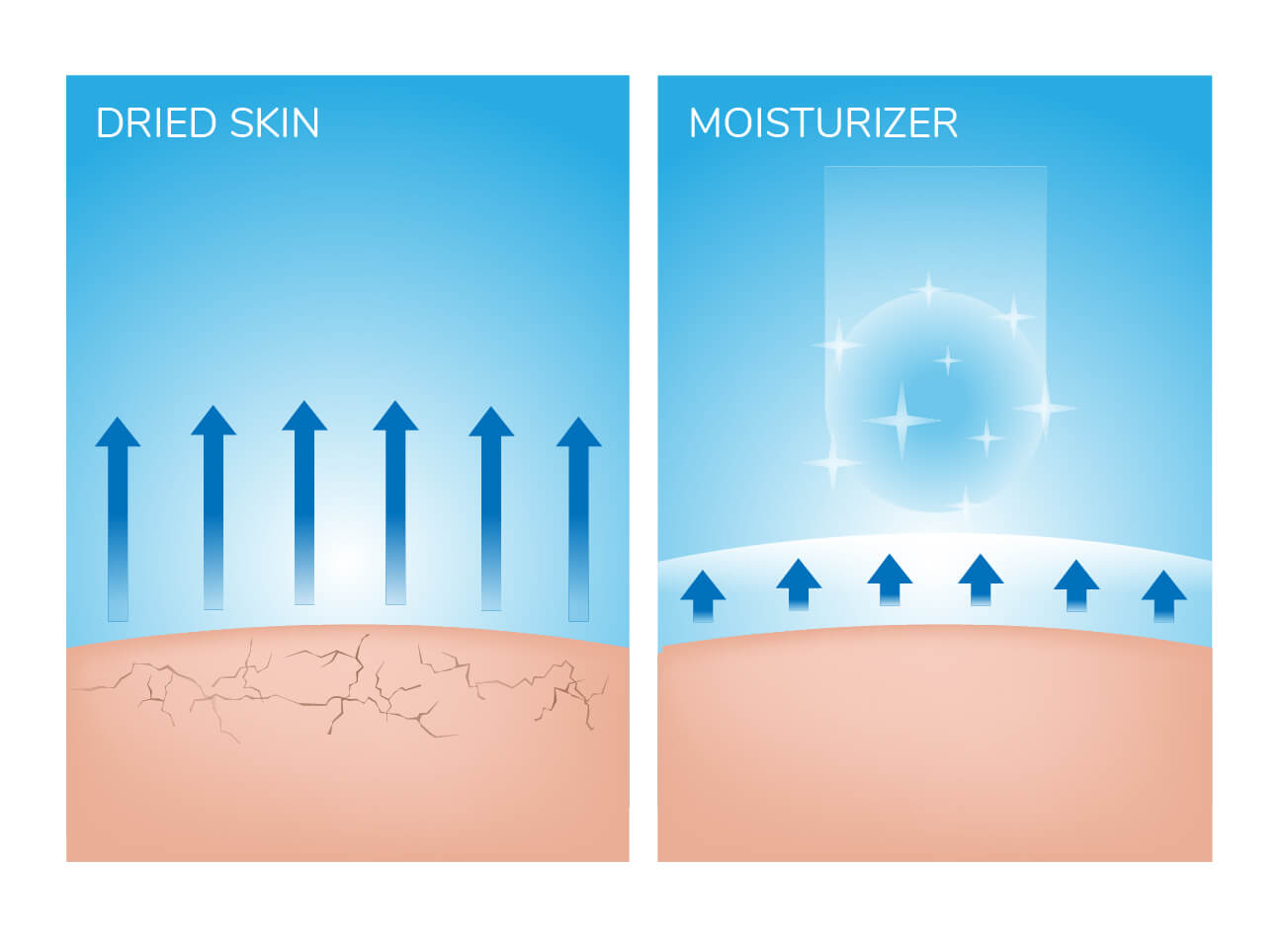 Illustration of dry versus moisturized skin