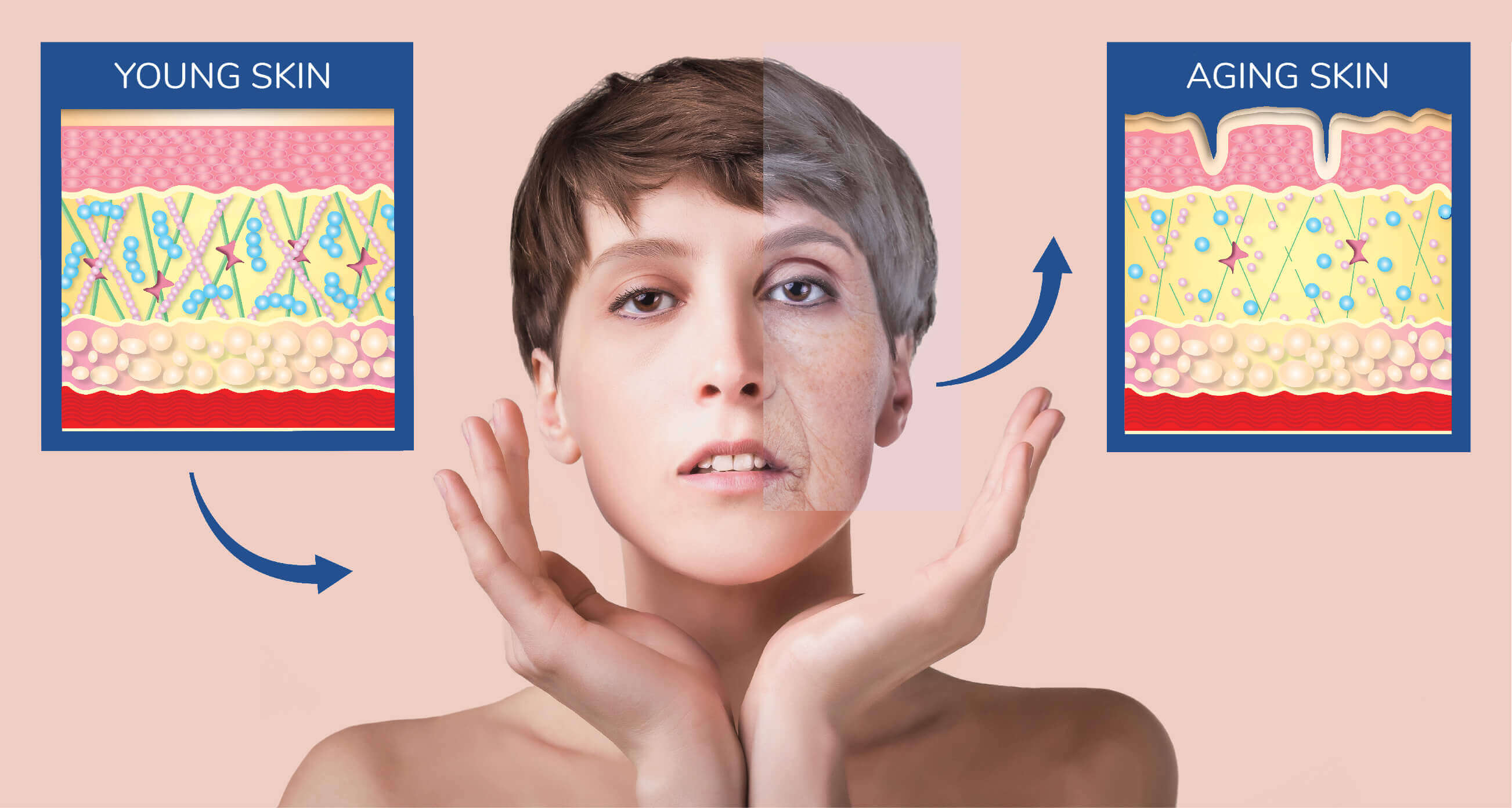 Illustration of young versus aging skin