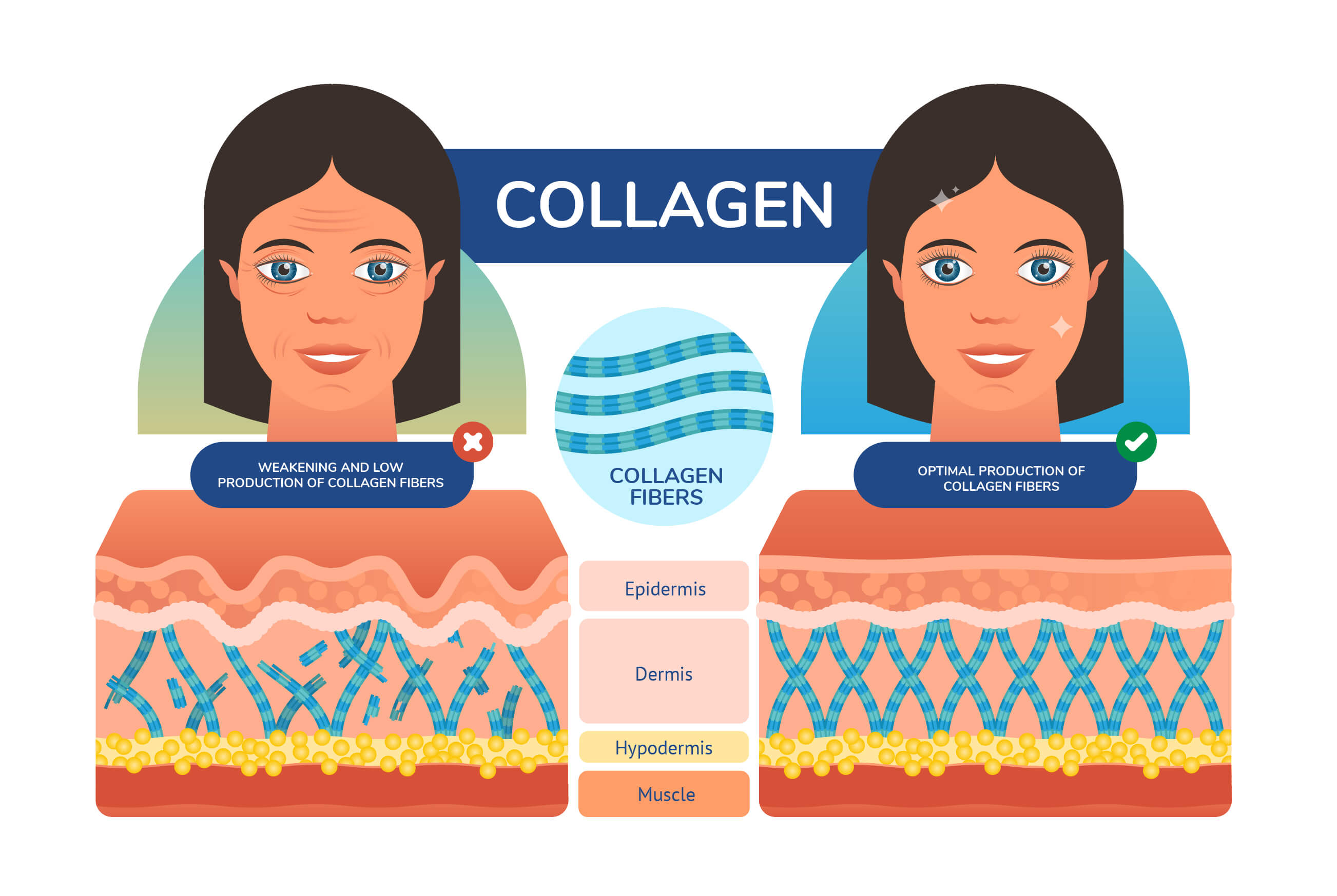 Charts illustrating skin's collagen structure - strong vs weak